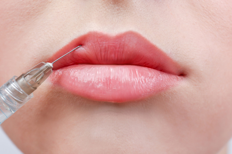 catalyst fargo lip injections