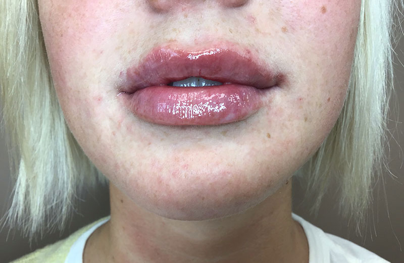 Haley-George-After-Lips-(1)
