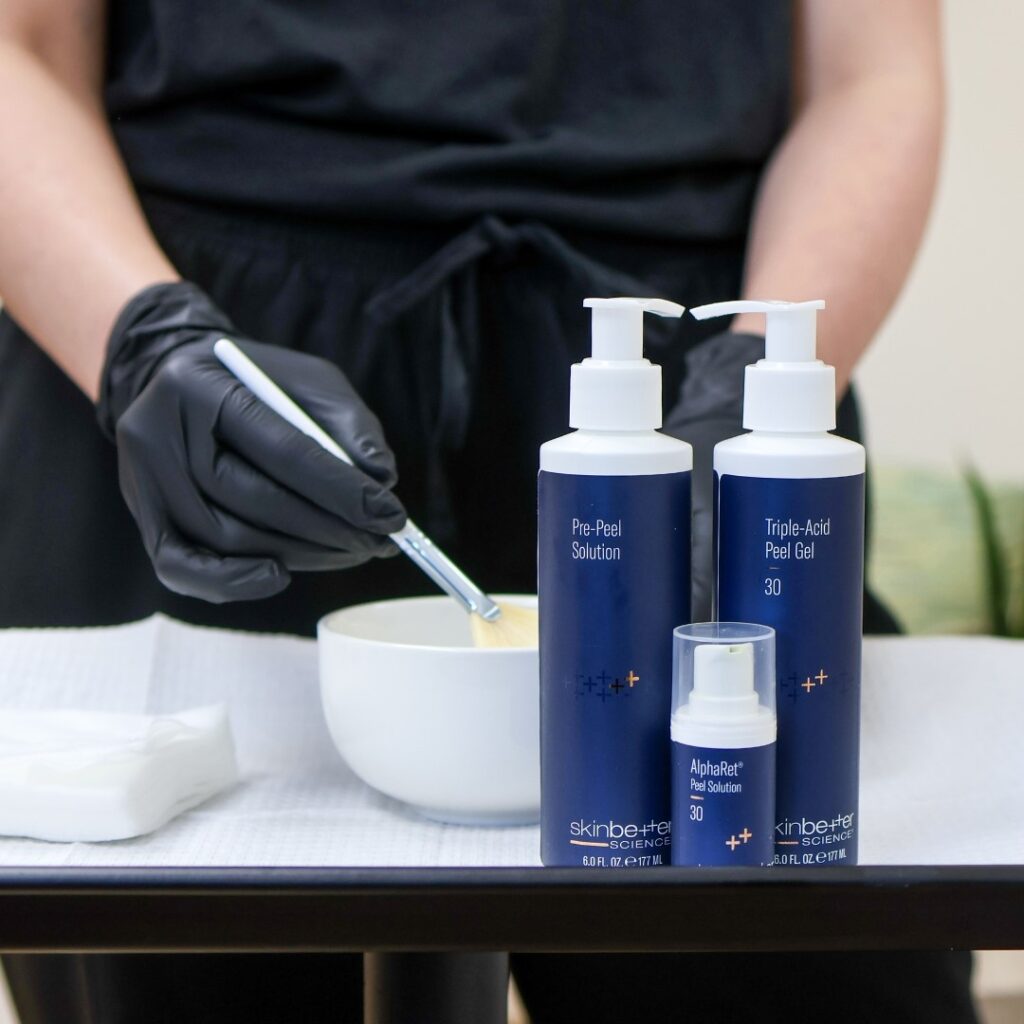 patient receiving alpharet peel treatment