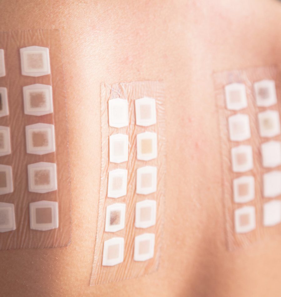 Allergy Testing Fargo Catalyst Medical Center Schedule A Test